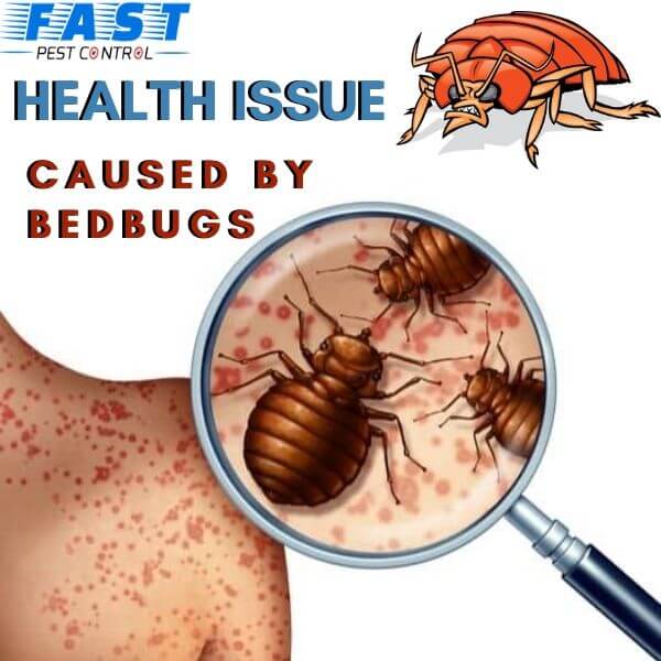 health issue caused by bugs